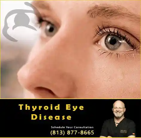 Dr Kwitko Thyroid Eyelid Disease Surgeon
